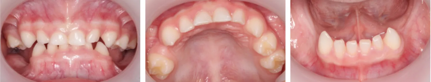 Fig. 3. Panoramic radiograph indicating the absence of multiple primary and permanent teeth.