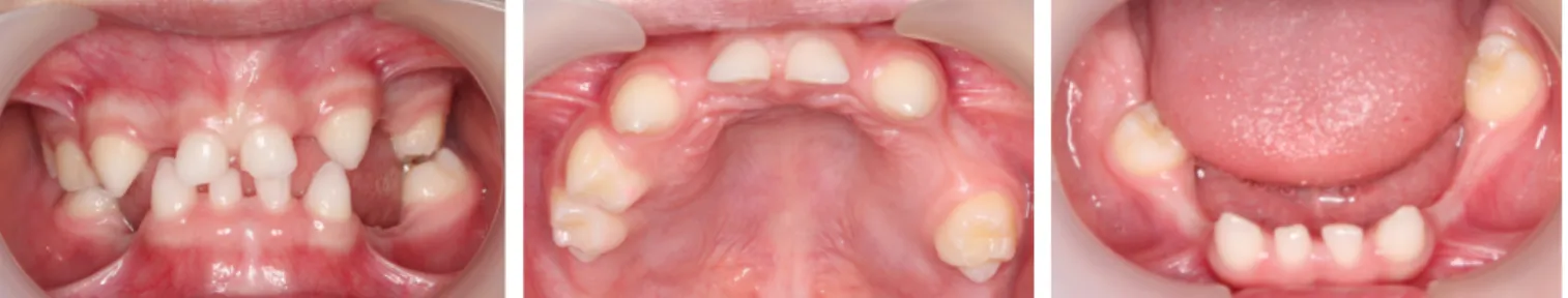 Fig. 7. Panoramic radiograph revealing the absence of multiple primary and permanent teeth.