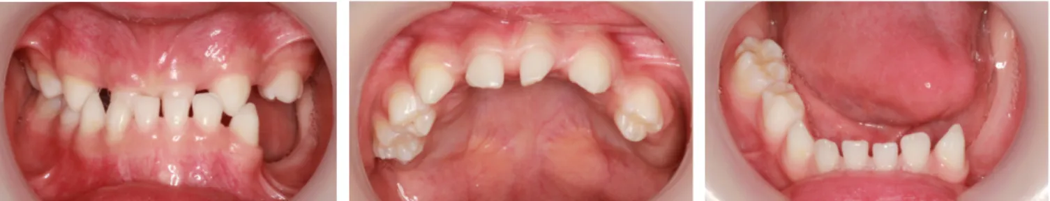 Fig. 11. Panoramic radiograph revealing the absence of multiple primary and permanent teeth.
