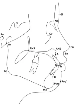 Fig. 2. The cephalometric landmarks used in this study. 
