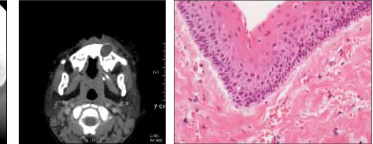 Fig. 6. Histologic finding (x400).