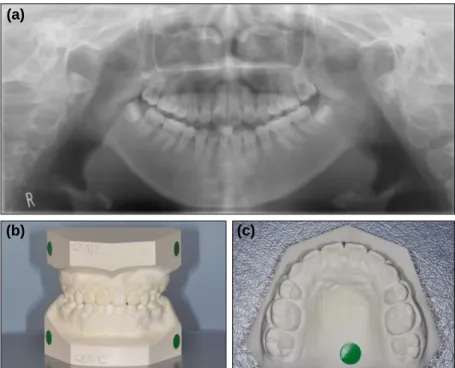 Fig. 6. Final records. (a) Panoramic view. The 4 first premolars were extracted and crowding was eliminated