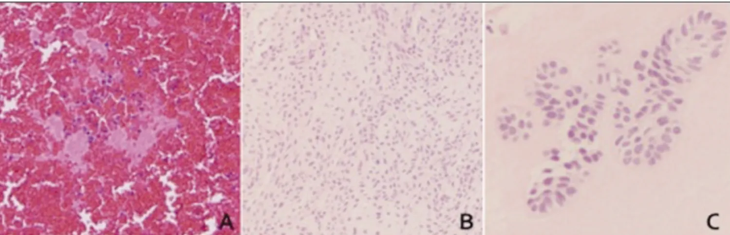 Fig. 6. Panoramic view (A) 18 months, (B) 36 months after the operation.