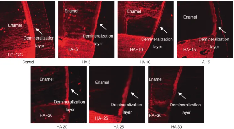 Fig. 3. SEM image of the sagittally sectioned enamel surface adjacent to the cement after acid demineralization (×2000).