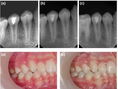 Fig.  4. (a)  Pre-treatment,  (b)  After  4  months.