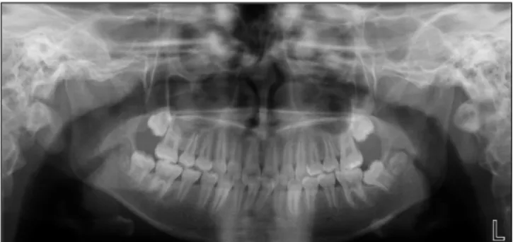 Fig. 5. Pre-treatment clinical view. Fig. 6. Pre-treatment panoramic view.