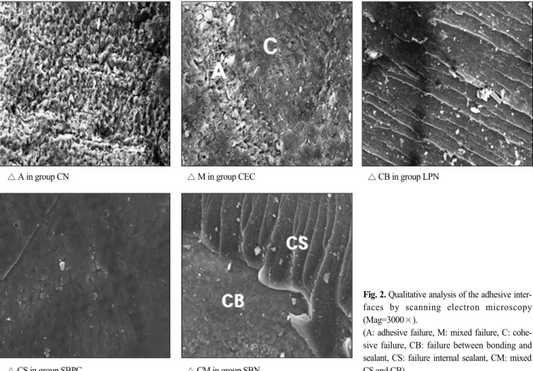 Fig. 2. Qualitative analysis of the adhesive inter- inter-faces  by  scanning  electron  microscopy (Mag=3000×)