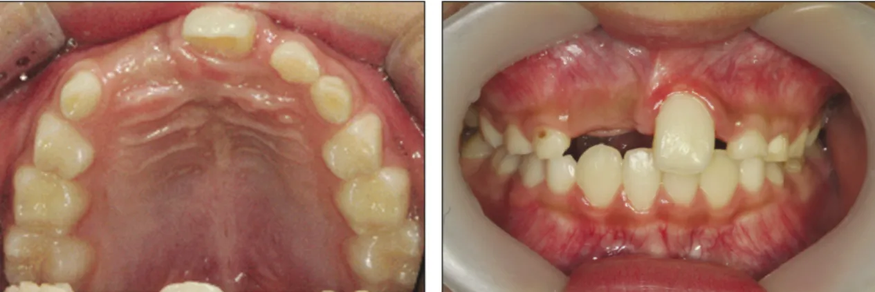 Fig. 3. Dental Cone Beam CT view after 8 months. 