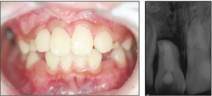 Fig. 13. After 30 months.