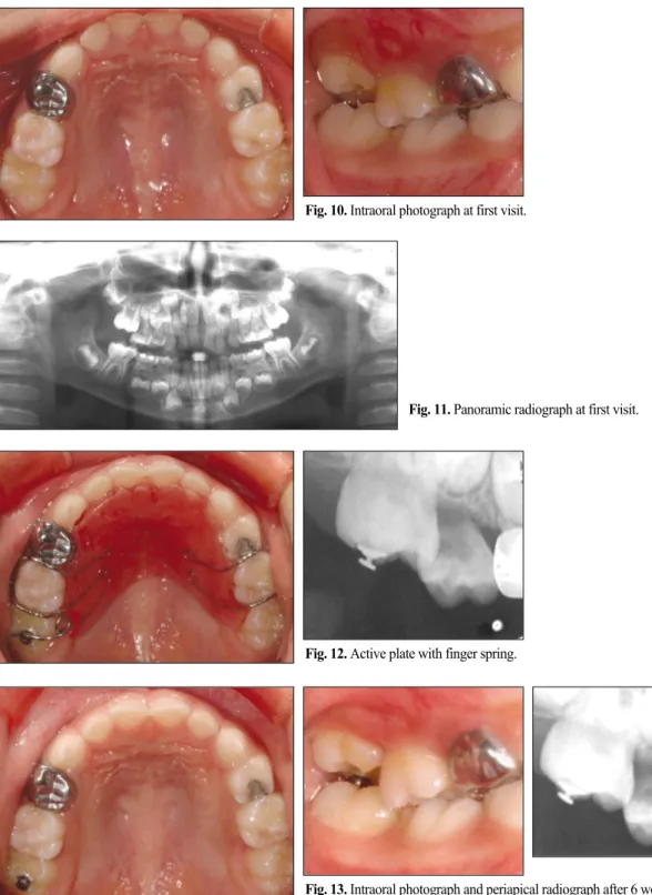 Fig. 10. Intraoral photograph at first visit.