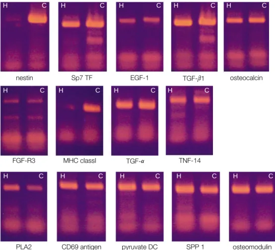 Fig. 8. The RT-PCR analysis was done selected genes.