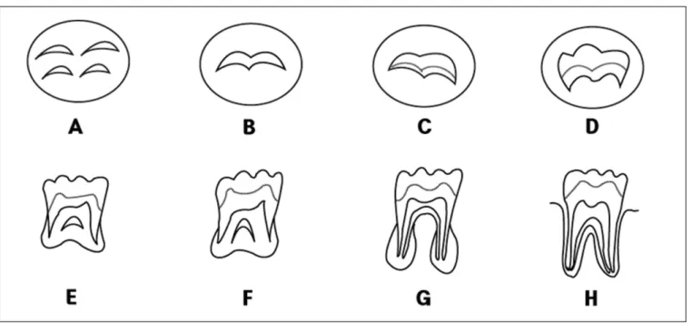Fig.  3. Diagram  of  structures  and  reference  planes  on  panoramic  radi- radi-ograph.
