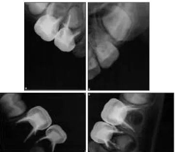 Fig. 6. postoperative intraoral occlusal views.