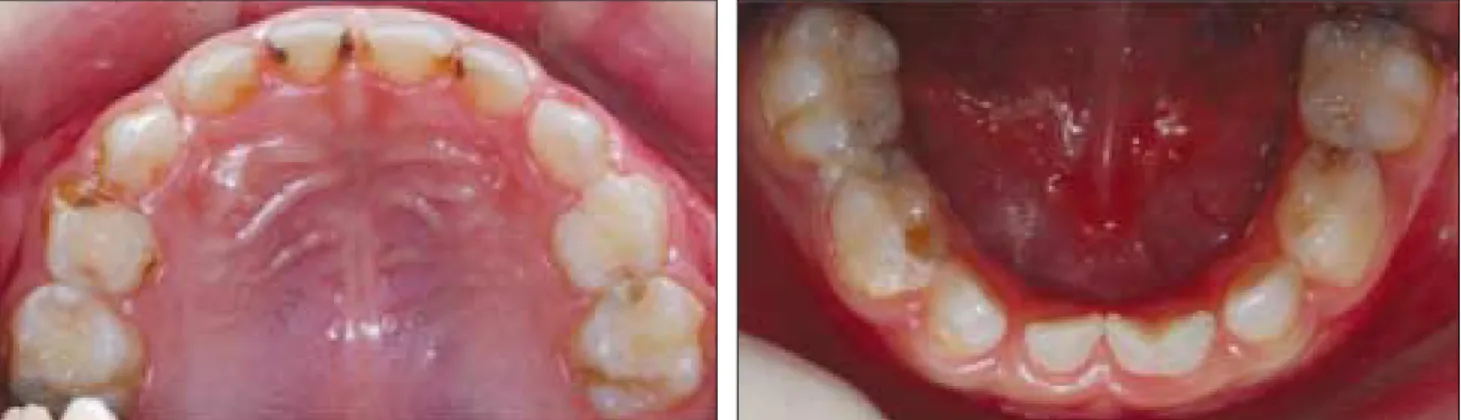 Fig 1. Preoperative intraoral view.