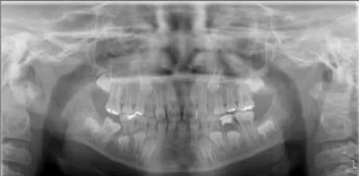 Fig. 8. 2 months after appliance delivery. Fig. 9. 2 years after treatment.