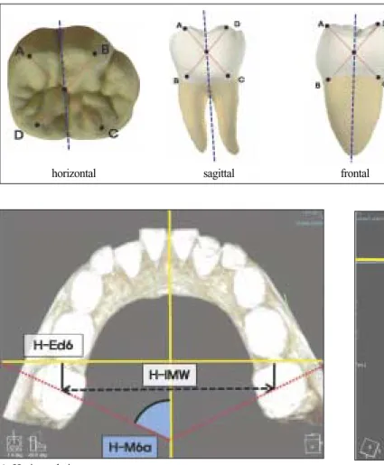 Fig. 3. The reference point and axis of the mandibular first molar.