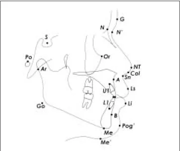 Fig. 1. Soft &amp; hard tissue landmarks used for cephalometric measurement.