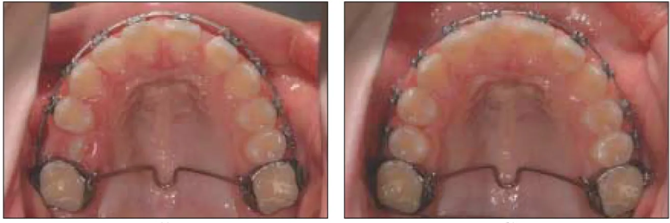 Fig. 7. Leveling and alignment. (a) 13 months after operation. (b) 16 months after operation.