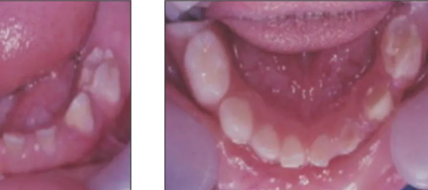 Fig. 1. Intraoral view.