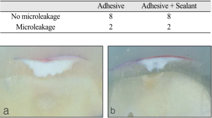 Fig. 4. No microleakage under adhesive(a) and sealant (b), (x10).