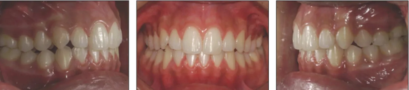Fig. 8. Intraoral view of post-treatment 2 yrs later.