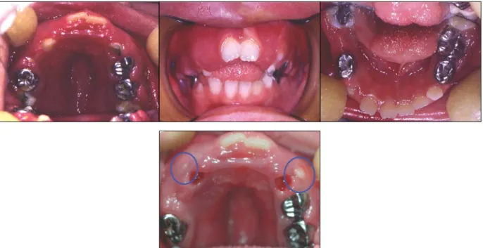 Fig. 2. Lateral cephalograph. 