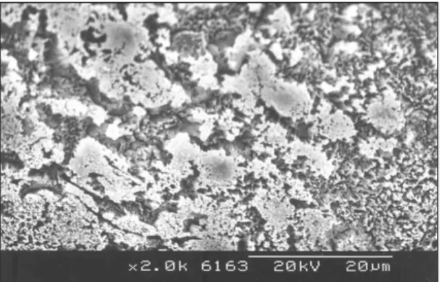 Fig. 2. Enamel surface etched with 35% phosphoric acid  for  15  seconds.  (Group  1)  The  periphery  of enamel prisms was dissolved
