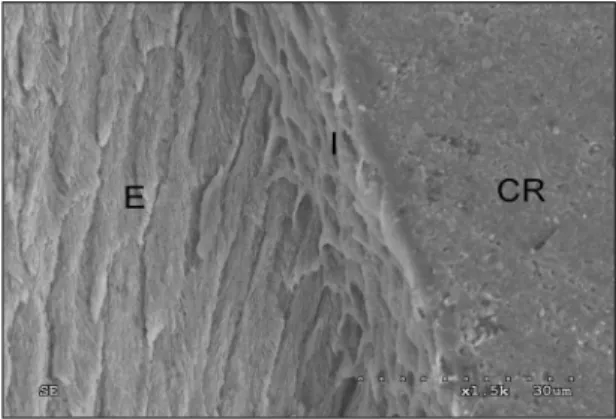 Fig. 3. SEM  image  of  resin-dentin  interface  in Group Ⅰ(×1500). 