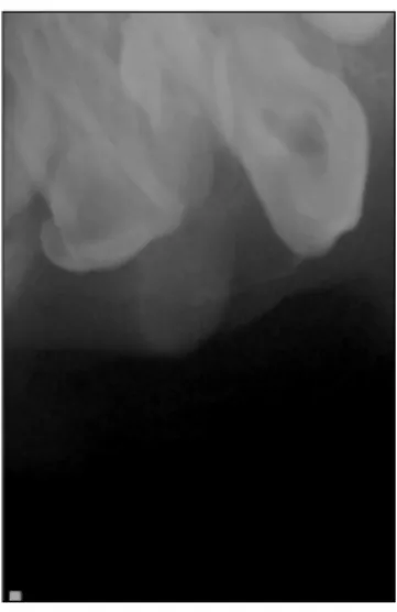 Fig. 3. CT-frontal view. Fig. 4. CT-frontal view.