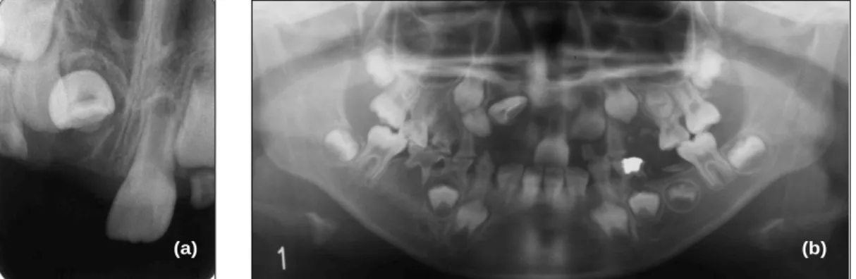 Fig. 2. (a) Periapical radiograph (b) Panorama radiograph.