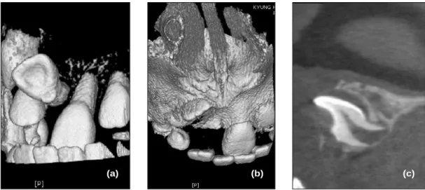 Fig. 3. Dental Cone Beam CT radiographs of pretreatment.