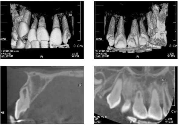 Fig. 7. CT radiographs at 2nd year after surgical repositioning.