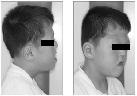 Fig. 3. Extraoral facial view.
