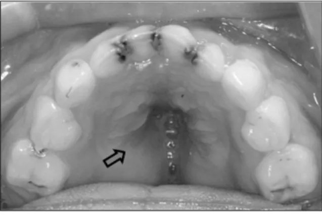 Fig. 8. Frontal view.