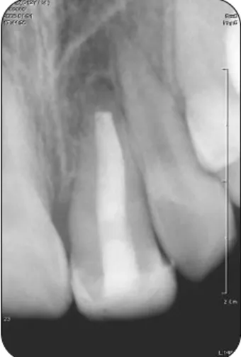 Fig. 9. Photograph after 24 months.