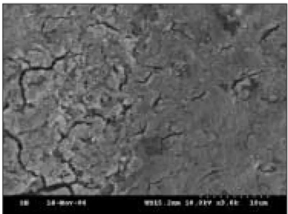 Fig. 2. SEM  photographs  of  primary  teeth  dentin.