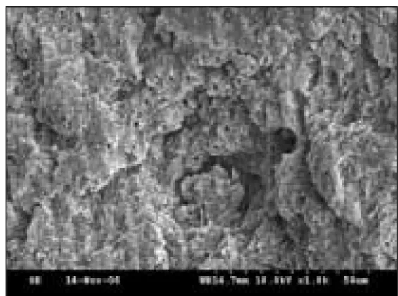 Fig. 8. SEM  photographs  of  primary  teeth  dentin.