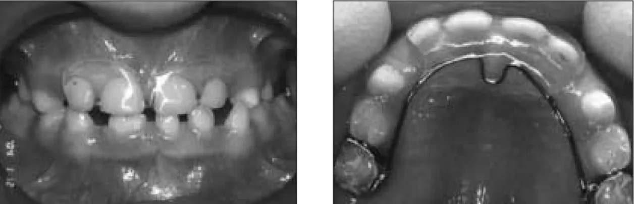 Fig. 4. Clinical follow-up radiograph after 3 years. 