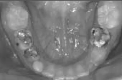 Fig. 4c. Right lateral view. Fig. 4d. Left lateral view.