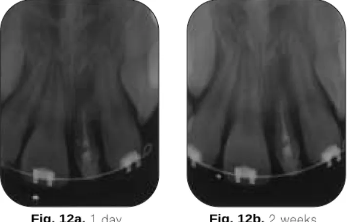 Fig. 12a. 1 day. Fig. 12b. 2 weeks. Fig. 12c. 1 month. Fig. 12d. 8 months.