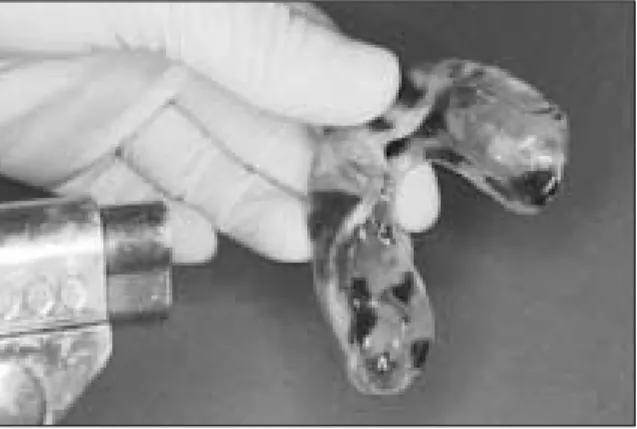 Fig. 7. Intraoral view with mouthguard wear.           Fig. 8. Intraoral view at first visit