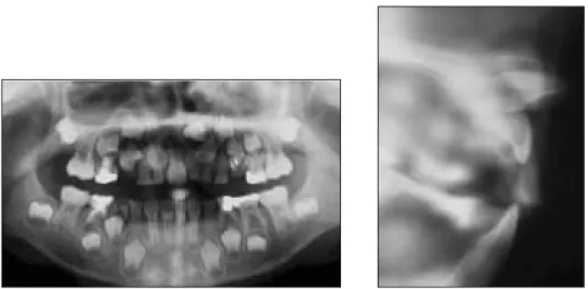 Fig. 1. Panoramic and tomographic view of pretreatment. 