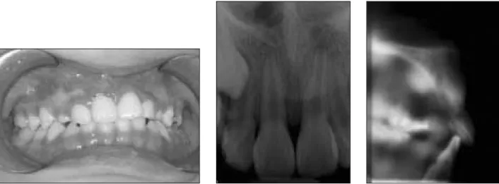 Fig. 3. After 28 months.