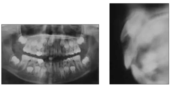 Fig. 7. Panoramic and tomographic view of pretreatment.