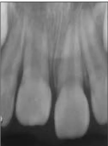 Fig. 9. After 11 months.