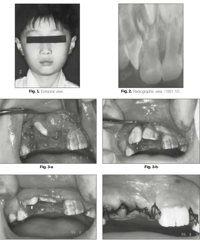 Fig. 3-c Fig. 3-d