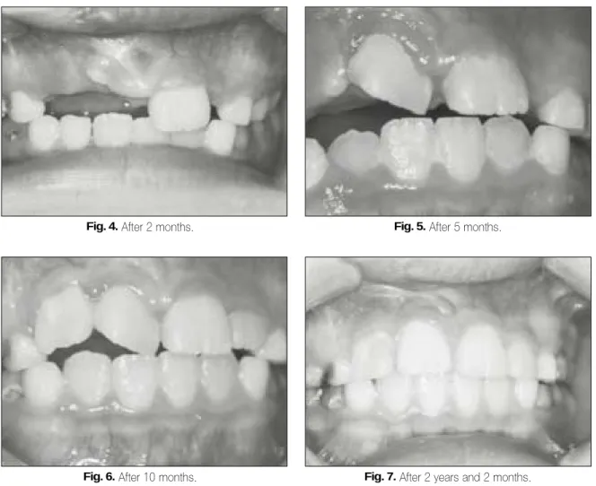 Fig. 6. After 10 months.