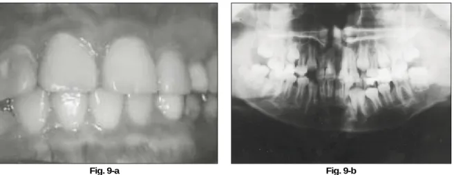 Fig. 9. After 3 years and 4 months.