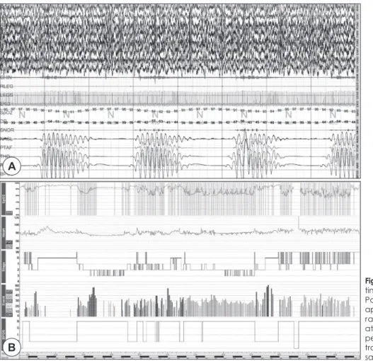 Figure 1. Before application of con- con-tinuous positive airway pressure. A :  Polysomnography shows central  apnea with Cheyne-stoked  respi-ration  and  decreased   oxygen-ation to 81% during NREM sleep  period