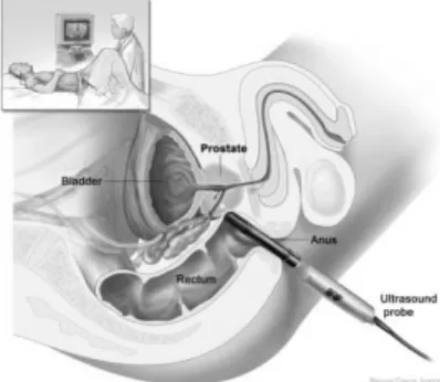 Fig. 1. Positions of US probe and prostate
